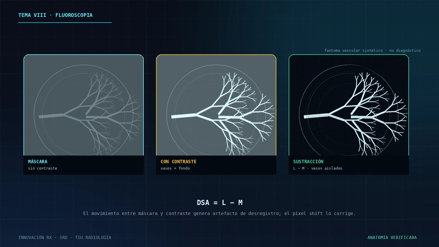 Fantoma vascular sintético para sustracción digital